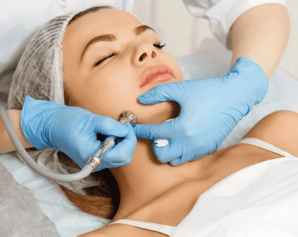Kent Clinic Skin Condition 4